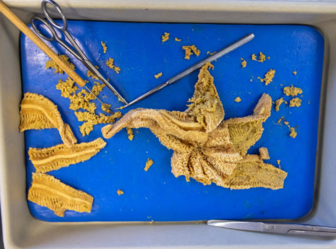 Dissected starfish. 